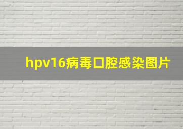 hpv16病毒口腔感染图片