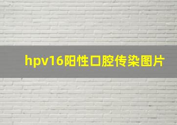 hpv16阳性口腔传染图片