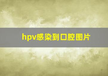 hpv感染到口腔图片