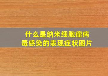 什么是纳米细胞瘤病毒感染的表现症状图片