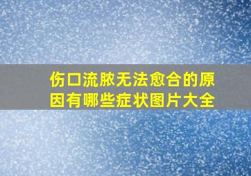 伤口流脓无法愈合的原因有哪些症状图片大全