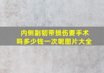 内侧副韧带损伤要手术吗多少钱一次呢图片大全