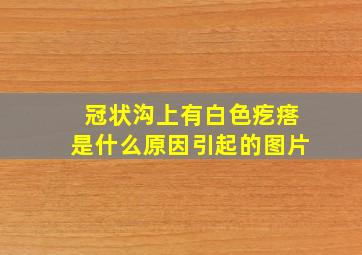 冠状沟上有白色疙瘩是什么原因引起的图片