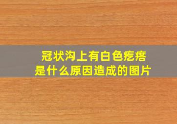 冠状沟上有白色疙瘩是什么原因造成的图片