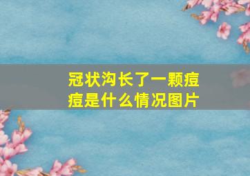 冠状沟长了一颗痘痘是什么情况图片