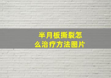 半月板撕裂怎么治疗方法图片