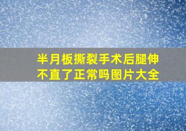 半月板撕裂手术后腿伸不直了正常吗图片大全