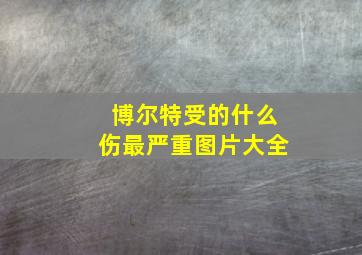 博尔特受的什么伤最严重图片大全