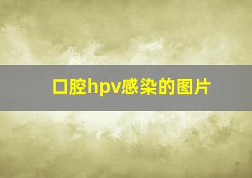 口腔hpv感染的图片