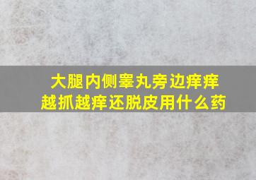 大腿内侧睾丸旁边痒痒越抓越痒还脱皮用什么药