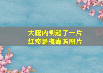 大腿内侧起了一片红疹是梅毒吗图片