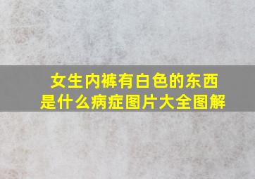 女生内裤有白色的东西是什么病症图片大全图解