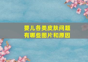 婴儿各类皮肤问题有哪些图片和原因