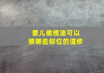 婴儿橄榄油可以擦哪些部位的湿疹