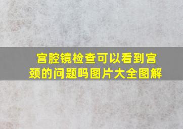 宫腔镜检查可以看到宫颈的问题吗图片大全图解