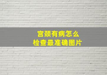 宫颈有病怎么检查最准确图片