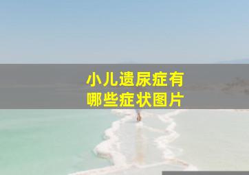 小儿遗尿症有哪些症状图片