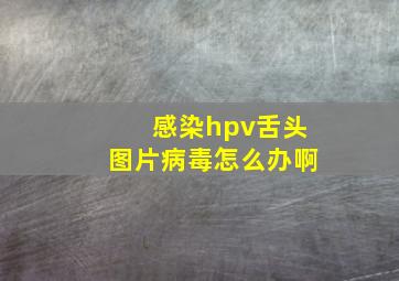 感染hpv舌头图片病毒怎么办啊