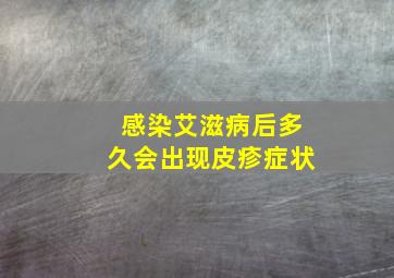 感染艾滋病后多久会出现皮疹症状