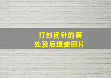 打封闭针的害处及后遗症图片