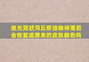 激光冠状沟丘疹结痂掉落后会恢复成原来的皮肤颜色吗