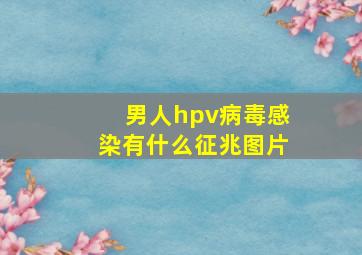 男人hpv病毒感染有什么征兆图片