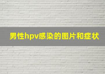 男性hpv感染的图片和症状