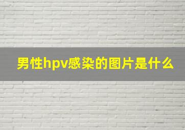 男性hpv感染的图片是什么