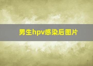 男生hpv感染后图片