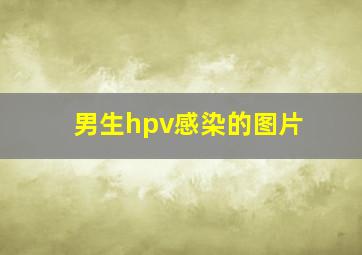 男生hpv感染的图片