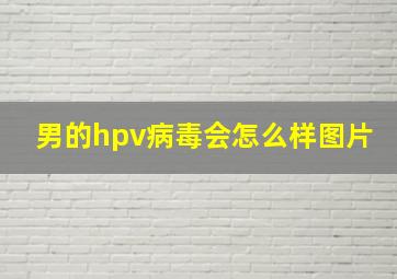 男的hpv病毒会怎么样图片