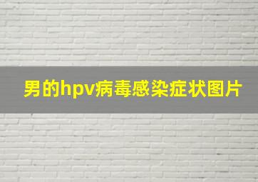 男的hpv病毒感染症状图片