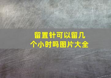 留置针可以留几个小时吗图片大全