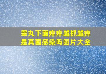 睾丸下面痒痒越抓越痒是真菌感染吗图片大全