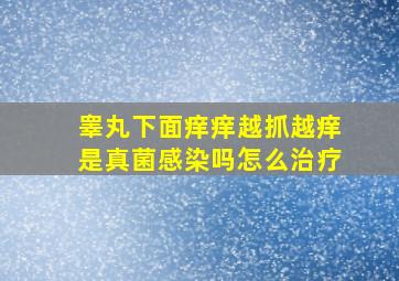 睾丸下面痒痒越抓越痒是真菌感染吗怎么治疗