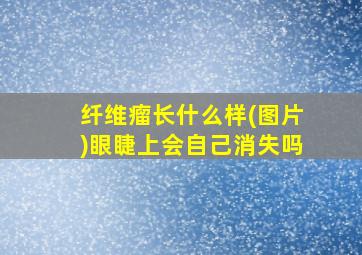 纤维瘤长什么样(图片)眼睫上会自己消失吗