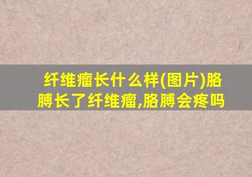 纤维瘤长什么样(图片)胳膊长了纤维瘤,胳膊会疼吗