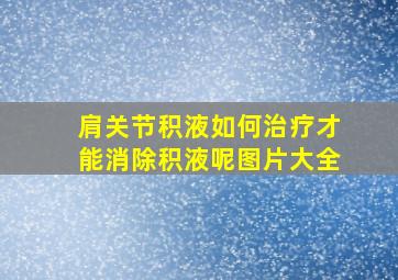 肩关节积液如何治疗才能消除积液呢图片大全