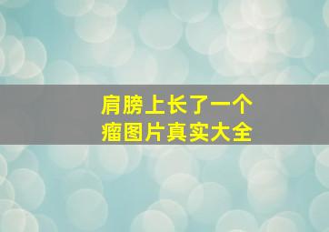 肩膀上长了一个瘤图片真实大全