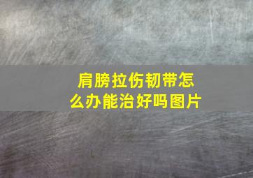 肩膀拉伤韧带怎么办能治好吗图片