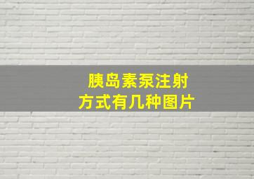 胰岛素泵注射方式有几种图片