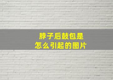 脖子后鼓包是怎么引起的图片