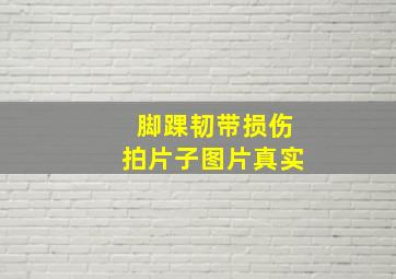 脚踝韧带损伤拍片子图片真实