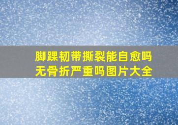 脚踝韧带撕裂能自愈吗无骨折严重吗图片大全