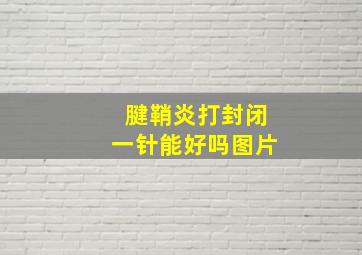 腱鞘炎打封闭一针能好吗图片