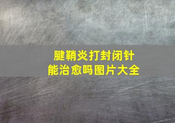 腱鞘炎打封闭针能治愈吗图片大全