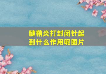 腱鞘炎打封闭针起到什么作用呢图片