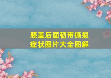 膝盖后面韧带撕裂症状图片大全图解