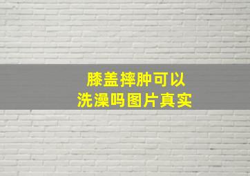 膝盖摔肿可以洗澡吗图片真实