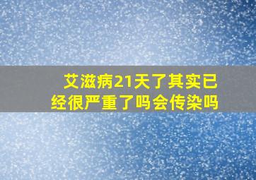 艾滋病21天了其实已经很严重了吗会传染吗